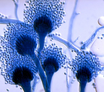 aspergillus spores